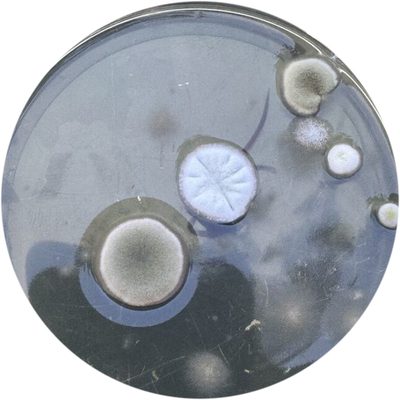Mold plate: the room before the box, several colonies